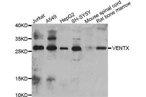 Western blot analysis of extracts of various cell lines, using VENTX antibody (ABIN5975554) at 1/1000 dilution.