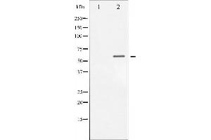 Western blot analysis of Chk1 phosphorylation expression in MCF7 whole cell lysates,The lane on the left is treated with the antigen-specific peptide. (CHEK1 Antikörper  (pSer317))