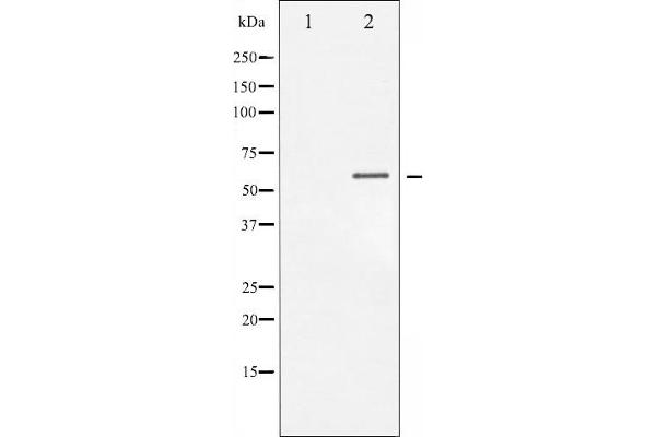 CHEK1 Antikörper  (pSer317)