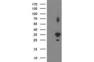 Western Blotting (WB) image for anti-Pleckstrin Homology Domain Containing Family A3 (PLEKHA3) antibody (ABIN1500273) (PLEKHA3 Antikörper)