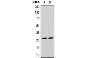Western blot analysis of CLIC4 expression in Raji (A), HeLa (B) whole cell lysates.