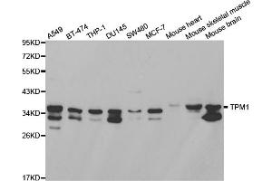Western blot analysis of extracts of various cell lines, using TPM1 antibody (ABIN2989338) at 1/1000 dilution. (Tropomyosin Antikörper)