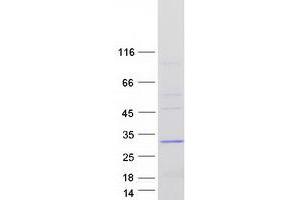 Western Blotting (WB) image for Abhydrolase Domain Containing 14B (ABHD14B) (Transcript Variant 2) protein (Myc-DYKDDDDK Tag) (ABIN2714275)