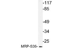 Western blot (WB) analysis of MRP-S36 antibody in extracts from HepG2 cells. (MRPS36 Antikörper)