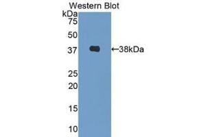 Western blot analysis of the recombinant protein. (Decorin Antikörper  (AA 31-359))
