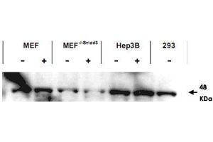 Western blot using SMAD3 polyclonal antibody  shows detection of endogenous SMAD3 in both unstimulated and stimulated cell lysates. (SMAD3 Antikörper  (AA 417-425))