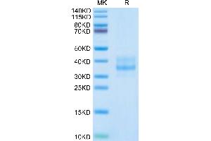 SDS-PAGE (SDS) image for LI Cadherin (AA 30-244) protein (His tag) (ABIN7274310)