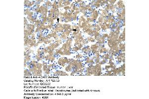 Human Liver (ACAT2 Antikörper  (Middle Region))