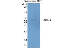 Western blot analysis of the recombinant protein. (CD25 Antikörper  (AA 22-243))