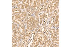 Immunohistochemistry of paraffin-embedded mouse kidney using [KO Validated]  Rabbit mAb (ABIN7271243) at dilution of 1:100 (40x lens). (AKT1 Antikörper)