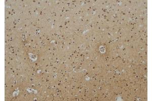 ABIN6257165 and ABIN6275114 at 1/100 staining Human brain tissue by IHC-P. (EPN3 Antikörper  (Internal Region))