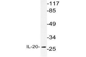 Western blot (WB) analysis of IL-20 antibody in extracts from A549 cells. (IL-20 Antikörper)