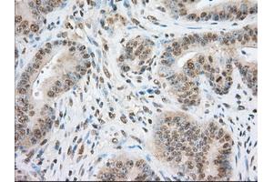 Image no. 8 for anti-Transforming, Acidic Coiled-Coil Containing Protein 3 (TACC3) antibody (ABIN1498099) (TACC3 Antikörper)