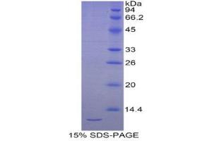 SDS-PAGE (SDS) image for Selenoprotein W, 1 (SEPW1) (AA 1-86) protein (His tag) (ABIN1821740) (Selenoprotein W Protein (AA 1-86) (His tag))