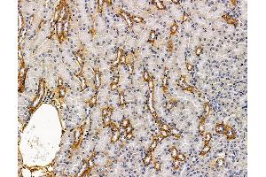 anti-UDP-N-Acetyl-alpha-D-Galactosamine:polypeptide N-Acetylgalactosaminyltransferase 2 (GalNAc-T2) (GALNT2) antibody