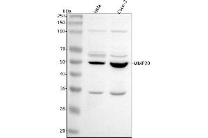 Western blot analysis of MMP20 using anti-MMP20 antibody (ABIN7599872).