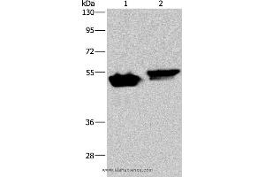 Western blot analysis of Raji and Hela cell, using AVEN Polyclonal Antibody at dilution of 1:200 (AVEN Antikörper)