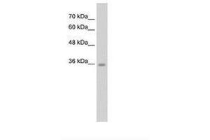 Image no. 1 for anti-Chromosome 6 Open Reading Frame 134 (C6orf134) (N-Term) antibody (ABIN203439)