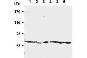 Western Blotting (WB) image for anti-Cell Division Cycle 25 Homolog C (S. Pombe) (CDC25C) antibody (ABIN487484) (CDC25C Antikörper)