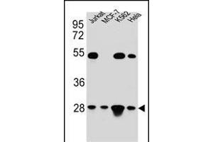 TF Antibody (C-term) (ABIN654229 and ABIN2844063) western blot analysis in Hela,Jurkat,K562,MCF-7 cell line lysates (35 μg/lane). (TFAM Antikörper  (C-Term))