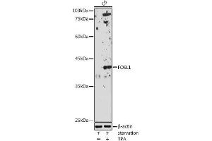Western blot analysis of extracts of C6 cells, using FOSL1 antibody (ABIN6131653, ABIN6140738, ABIN6140739 and ABIN6221016) at 1:1000 dilution. (FOSL1 Antikörper  (AA 1-100))