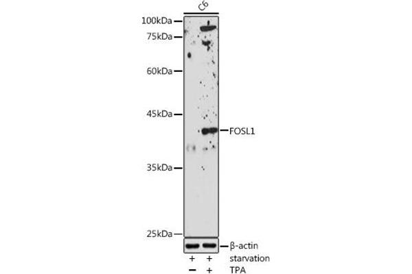 FOSL1 Antikörper  (AA 1-100)