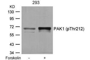 Western blot analysis of extracts from 293 cells untreated or treated with forskolin using PAK1(Phospho-Thr212) Antibody. (PAK1 Antikörper  (pThr212))