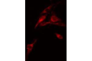 ABIN6274272 staining COLO205 cells by IF/ICC. (FXR2 Antikörper  (C-Term))