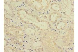 Immunohistochemistry of paraffin-embedded human kidney tissue using ABIN7153109 at dilution of 1:100 (FTCD Antikörper  (AA 412-541))