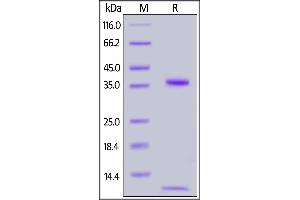 FCGRT & B2M (AA 24-297) protein (His tag,AVI tag,Biotin)
