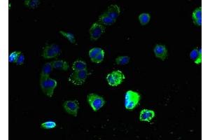 Immunofluorescent analysis of MCF-7 cells using ABIN7153339 at dilution of 1:100 and Alexa Fluor 488-congugated AffiniPure Goat Anti-Rabbit IgG(H+L) (GPR3 Antikörper  (AA 300-330))