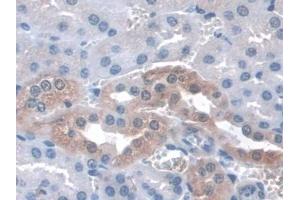 Immunohistochemistry (IHC) image for anti-Integrin, alpha 3 (ITGA3) (AA 33-236) antibody (ABIN7433390)