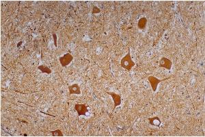Immunohistochemistry staining of human cerebellum (paraffin-embedded sections) with anti-neurofilament heavy protein (NF-01).
