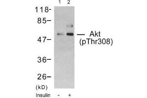 Western blot analysis using Akt (phospho-Thr308) antibody (E011055): Lane1: The extract from 293 cells untreated, Lane 2: The extract from 293 cells treated with insulin. (AKT1 Antikörper  (pThr308))