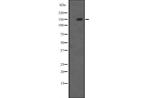 NRIP1 Antikörper  (C-Term)