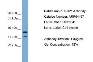 WB Suggested Anti-KCTD21  Antibody Titration: 0. (KCTD21 Antikörper  (Middle Region))