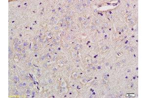 Formalin-fixed and paraffin embedded rat brain tissue labeled with Anti-Glypican 5 Polyclonal Antibody, Unconjugated at 1:200 followed by conjugation to the secondary antibody