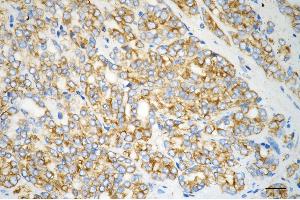 anti-Adrenoceptor alpha 1A (ADRA1A) antibody