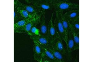 IF analysis of SUCLG2 using anti-SUCLG2 antibody (ABIN7601694). (SUCLG2 Antikörper  (AA 42-424))