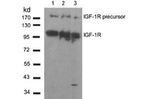 Image no. 2 for anti-Insulin-Like Growth Factor 1 Receptor (IGF1R) (Tyr1280) antibody (ABIN197576) (IGF1R Antikörper  (Tyr1280))