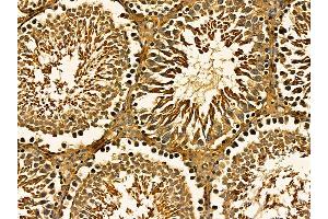 ABIN7095660 and ABIN7099722 at 1/100 staining rat testis tissue by IHC-P. (Ethanolamine Kinase 1 Antikörper)