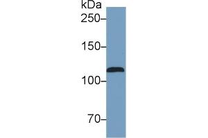 Detection of NOS2 in Human Serum using Monoclonal Antibody to Nitric Oxide Synthase 2, Inducible (NOS2) (NOS2 Antikörper  (AA 734-966))