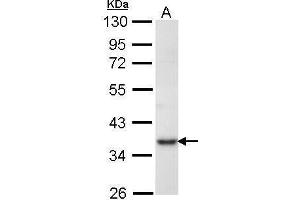 WB Image Sample (30 ug of whole cell lysate) A: Molt-4 , 10% SDS PAGE antibody diluted at 1:1000 (PRPS1 Antikörper)