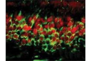 Dnmt3a Immunofluorescence. (DNMT3A Antikörper  (C-Term))