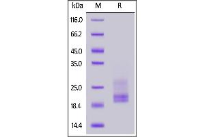 Human CD3E&CD3G Heterodimer Protein, His Tag&Tag Free on  under reducing (R) condition.