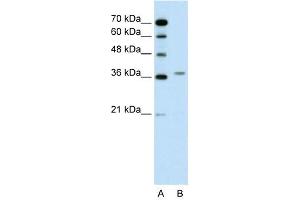 WB Suggested Anti-ALAD  Antibody Titration: 0. (ALAD Antikörper  (N-Term))