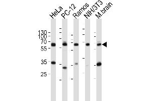 Western blot analysis of lysates from HeLa, rat PC-12, Ramos, mouse NIH/3T3 cell line, mouse brain tissue lysate(from left to right), using PKM2-N491 at 1:1000 at each lane. (Pyruvate Kinase Antikörper  (C-Term))