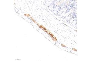 Immunohistochemistry (Paraffin-embedded Sections) (IHC (p)) image for anti-Peripherin (PRPH) antibody (ABIN7075012)