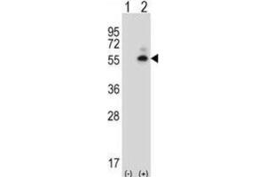 Western Blotting (WB) image for anti-Calcium/calmodulin-Dependent Protein Kinase II delta (CAMK2D) antibody (ABIN5017149) (CAMK2D Antikörper)