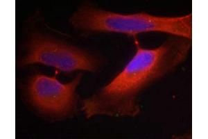 Immunofluorescence staining of methanol-fixed Hela cells using Keratin 8(Phospho-Ser74) Antibody. (KRT8 Antikörper  (pSer74))